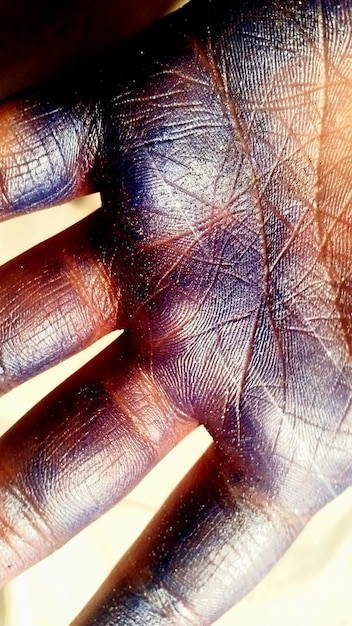 A close-up of Vander's hand, bruised and scarred, with faint blue veins suggesting an early stage of Shimmer exposure or transformation, contrasting with his strong, protective demeanor.